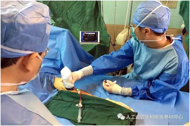 Wireless Palm Ultrasound Used in Vascular