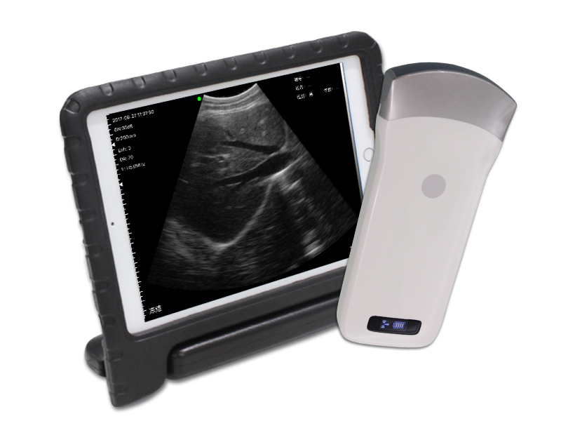 3C convex palm B/W ultrasound scanner