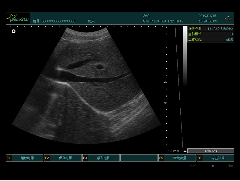 2023032511069135.png image.png