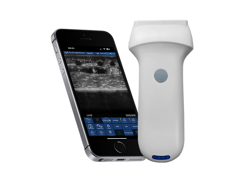 8X Accurate Puncture Linear Handheld Color Wireless Probe Type Ultrasound Scanner(VIP Exclusive)