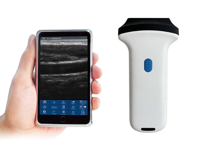 2L linear palm doppler ultrasound scanner